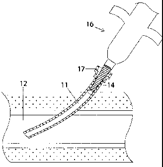 A single figure which represents the drawing illustrating the invention.